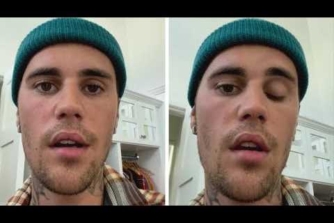 Justin Bieber Reveals His Face Is PARALYZED