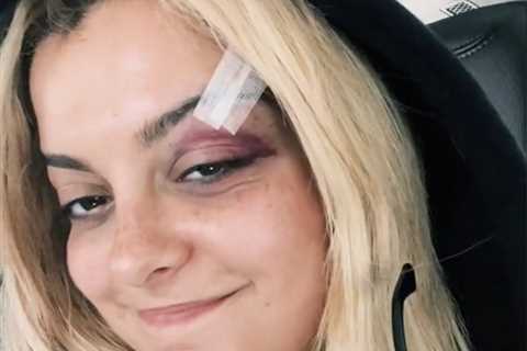 Concertgoer Who Threw Phone At Bebe Rexha Thought “It Would Be Funny”