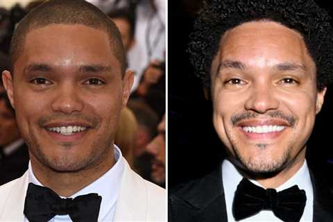 Trevor Noah -- Good Genes or Good Docs?!