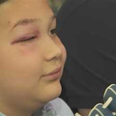 Mookie Betts’ foul ball strikes 8-year-old boy in eye at Dodgers home game