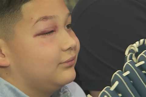 Mookie Betts’ foul ball strikes 8-year-old boy in eye at Dodgers home game