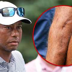 Tiger Woods Shows Off Gnarly Leg Scars Three Years After Car Crash