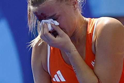 Olympics turns turns gruesome with bloody women’s field hockey scene