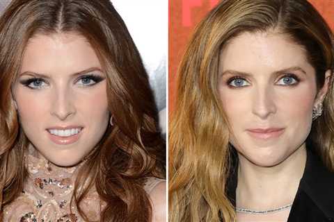 Anna Kendrick -- Good Genes or Good Docs?!