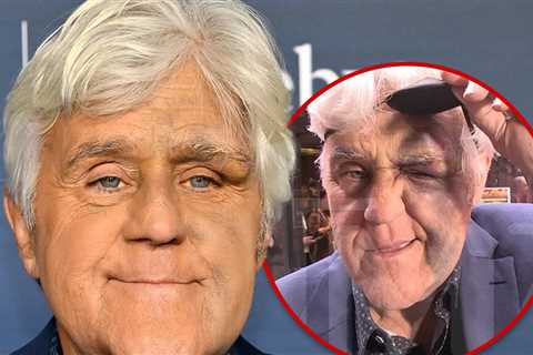 Jay Leno Looking Better After Nasty Fall Did Serious Damage to His Face