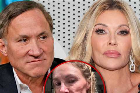 Dr. Terry Dubrow May Suggest Surgery for Brandi Glanville, She Wants Her Face Back