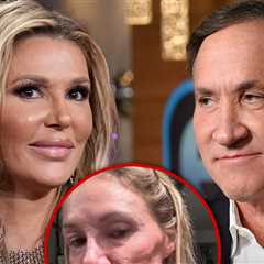 Brandi Glanville to Undergo Surgery From Dr. Terry Dubrow for Mystery Illness