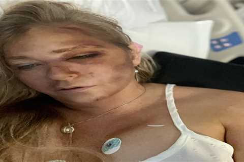 Bus driver in Virginia Giuffre crash speaks out as she shares hospital photo
