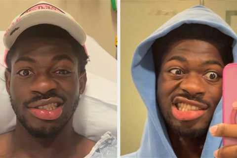 Lil Nas X Has Updated Fans After Losing Control Of The Entire Right Side Of His Face