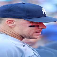 Aaron Judge bloodied after getting hit by Anthony Volpe throw between innings in wild Yankees moment
