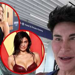 Human Ken Doll Says He's Loving Celebs Finally Owning Up To Plastic Surgery
