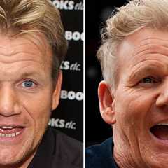 Gordon Ramsay Good Genes or Good Docs?!