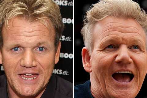 Gordon Ramsay Good Genes or Good Docs?!