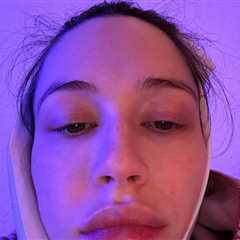 Elsie Hewitt Had Surgery to Get Wisdom Tooth Removed Day After Giving Birth