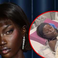 Supermodel Anok Yai Diagnosed with Congenital Lung Defect