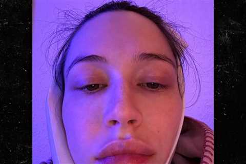 Elsie Hewitt Had Surgery to Get Wisdom Tooth Removed Day After Giving Birth