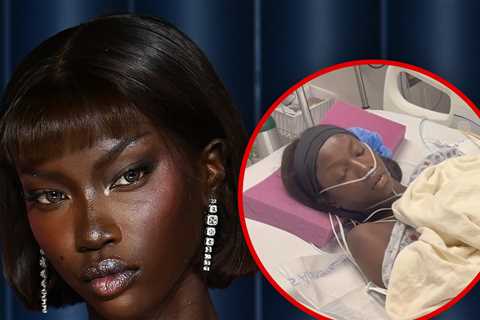 Supermodel Anok Yai Diagnosed with Congenital Lung Defect