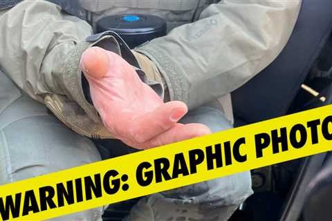 Homeland Security Assistant Secretary Claims Rioters Bit Off Agent's Finger in Minnesota