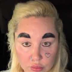 Amanda Bynes Continuing With Ozempic Journey, Wants to Lose 30 More Pounds