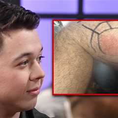 Gun Rights Activist Kyle Rittenhouse Hospitalized for Spider Bite