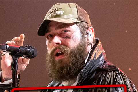 Post Malone Cancels First Few Weeks of Upcoming Tour