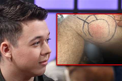 Gun Rights Activist Kyle Rittenhouse Hospitalized for Spider Bite