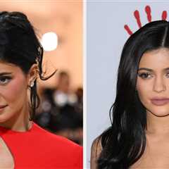 New Photos Of Kylie Jenner Are Going Viral Because People Think She’s Got Her “Old Face” Back