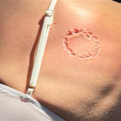 Puka Nacua’s biting case takes another surprising turn