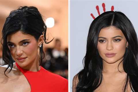 New Photos Of Kylie Jenner Are Going Viral Because People Think She’s Got Her “Old Face” Back