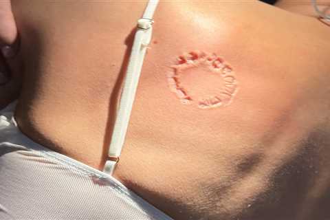 Puka Nacua’s biting case takes another surprising turn